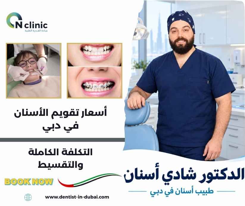 أسعار تقويم الأسنان في دبي