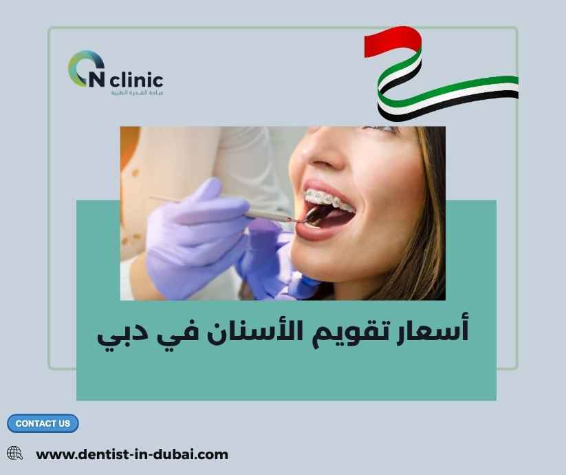 أسعار تقويم الأسنان في دبي