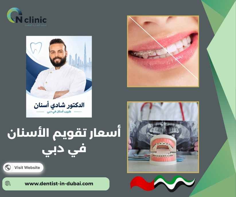 أسعار تقويم الأسنان في دبي