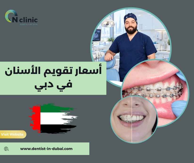 أسعار تقويم الأسنان في دبي