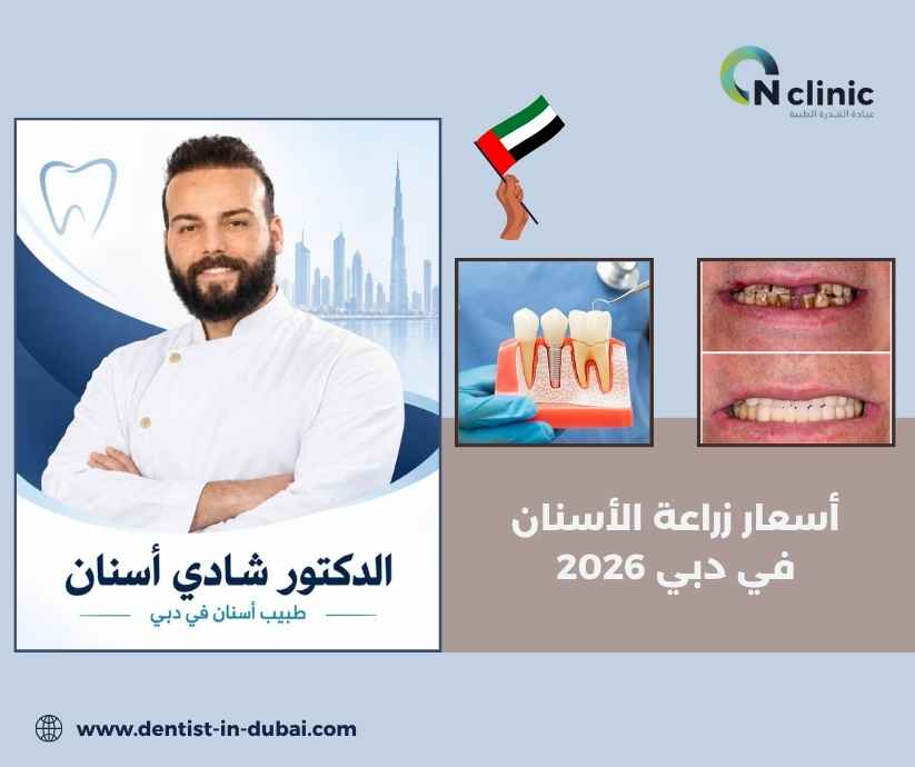 أسعار زراعة الأسنان في دبي 2026