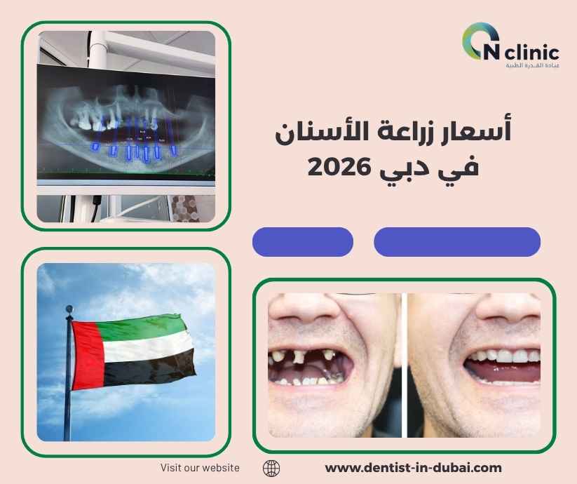 أسعار زراعة الأسنان في دبي 2026