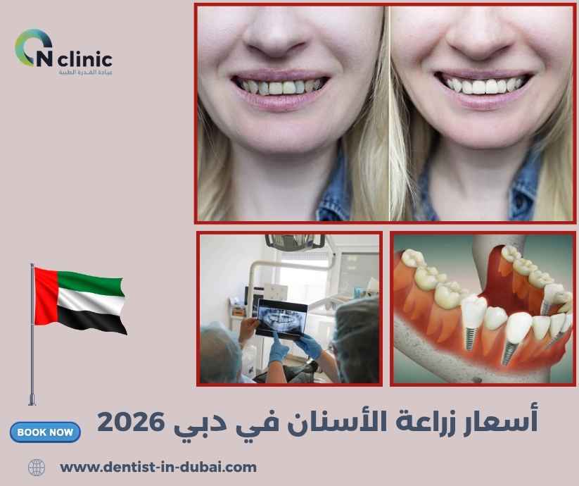 أسعار زراعة الأسنان في دبي 2026
