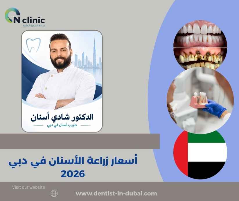 أسعار زراعة الأسنان في دبي 2026
