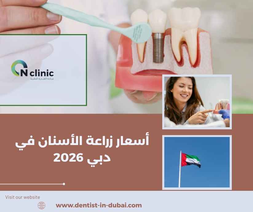 أسعار زراعة الأسنان في دبي 2026