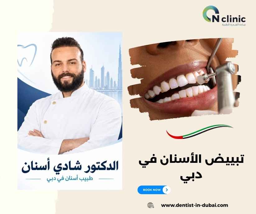 تبييض الأسنان في دبي