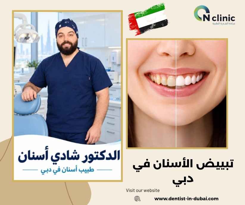 تبييض الأسنان في دبي