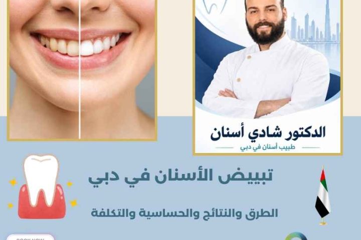 تبييض الأسنان في دبي