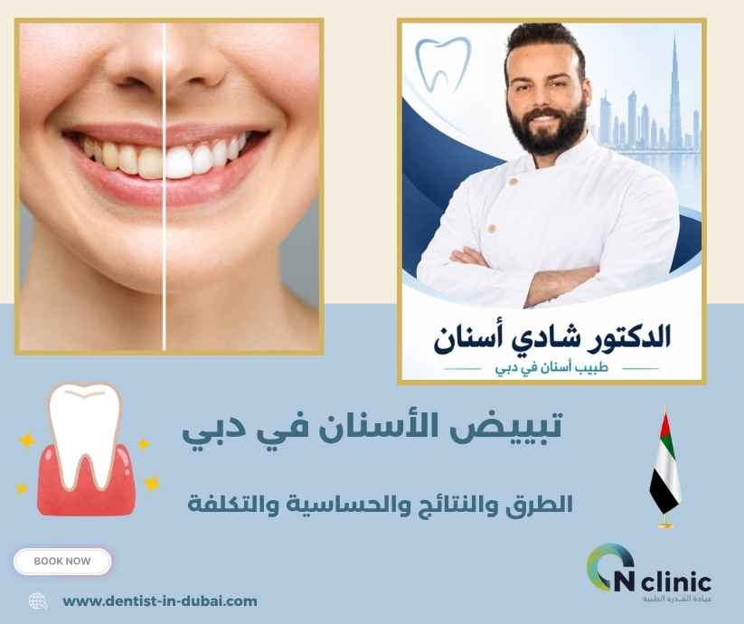 تبييض الأسنان في دبي