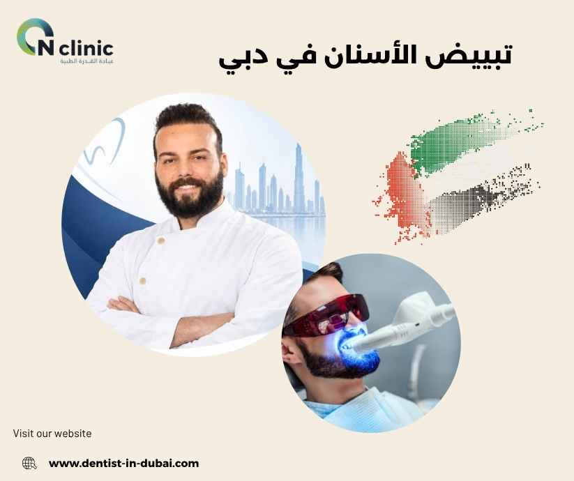 تبييض الأسنان في دبي