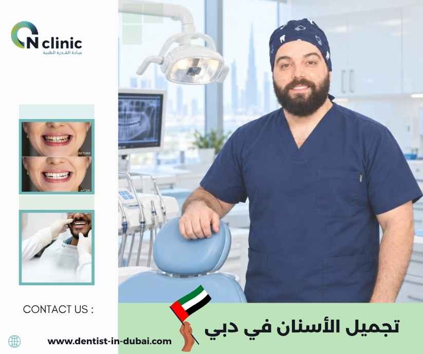 تجميل الأسنان في دبي تجميل الأسنان في دبي