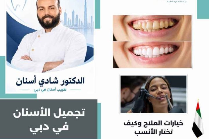 تجميل الأسنان في دبي