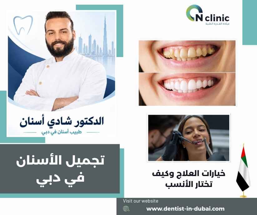تجميل الأسنان في دبي