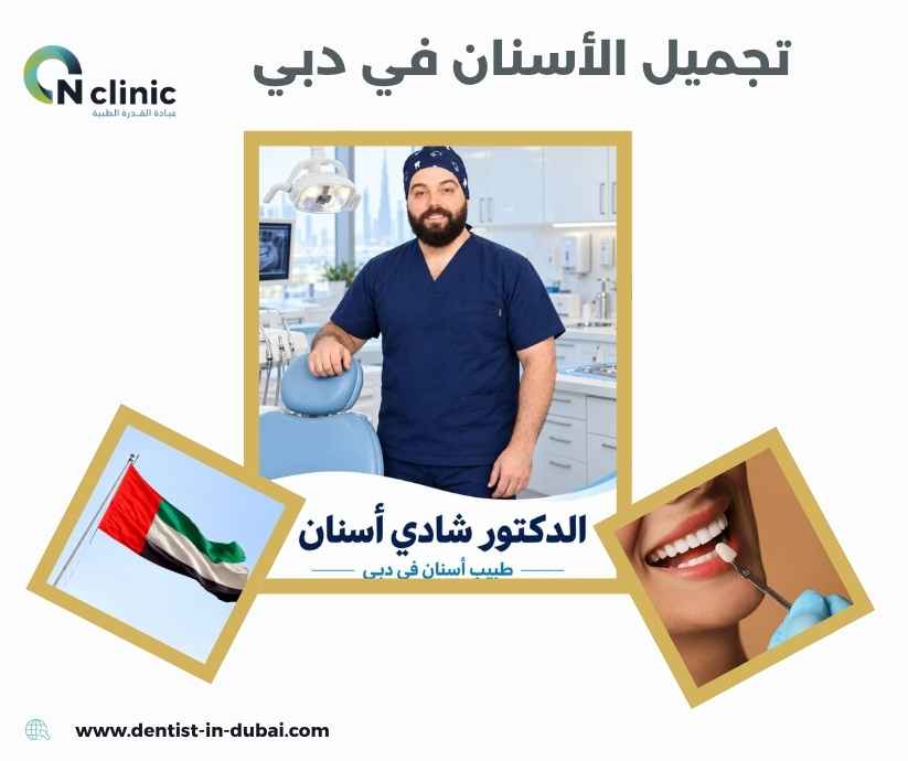 تجميل الأسنان في دبي تجميل الأسنان في دبي