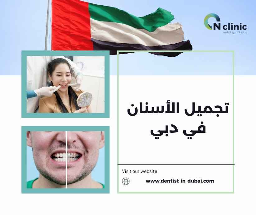 تجميل الأسنان في دبي تجميل الأسنان في دبي