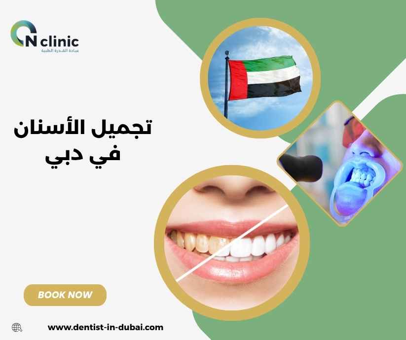 تجميل الأسنان في دبي تجميل الأسنان في دبي