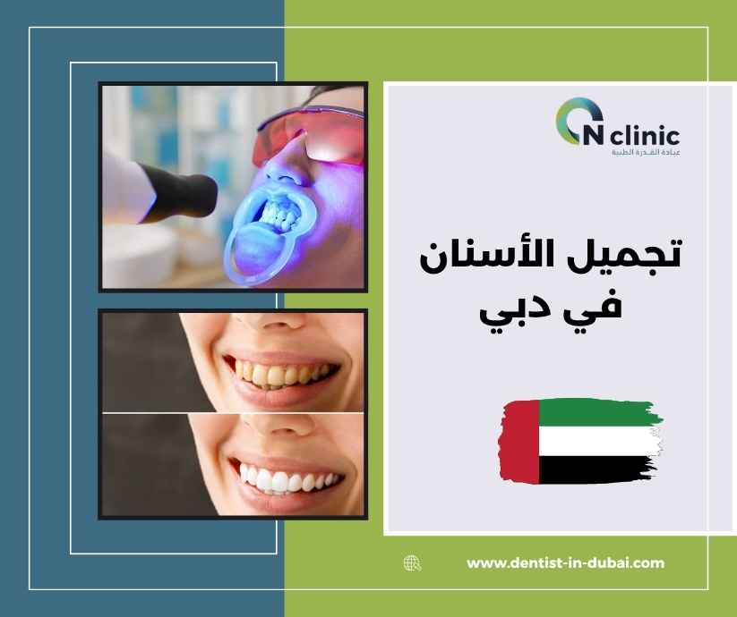 تجميل الأسنان في دبي تجميل الأسنان في دبي