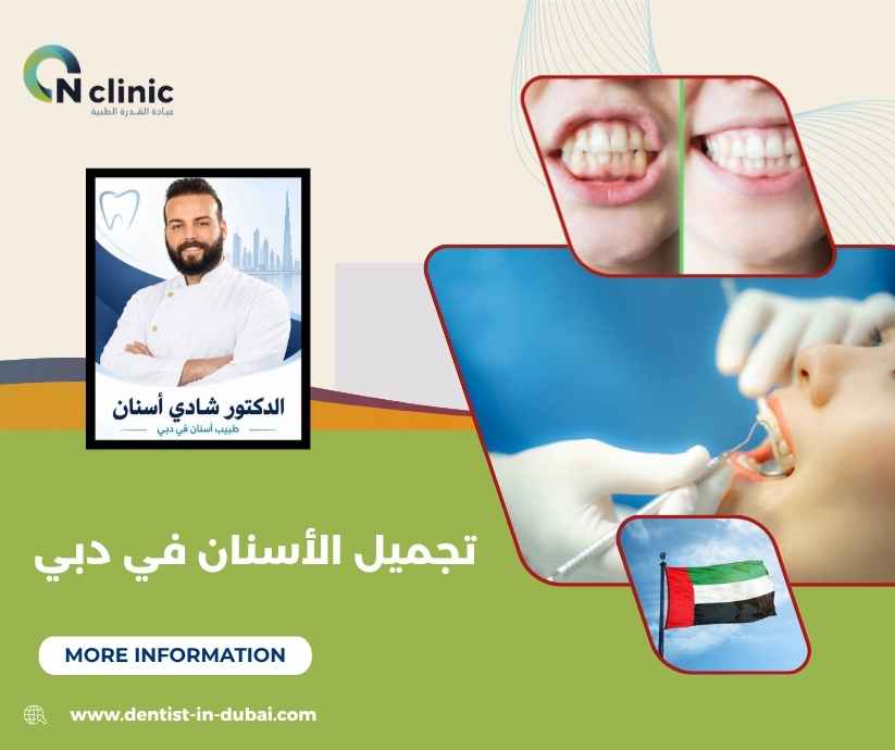 تجميل الأسنان في دبي تجميل الأسنان في دبي