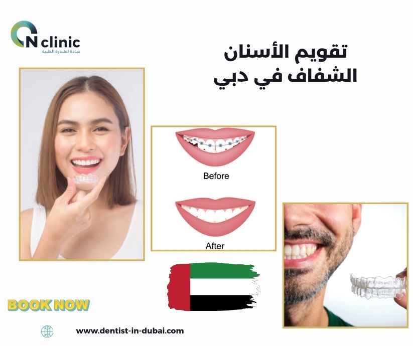 تقويم الأسنان الشفاف في دبي