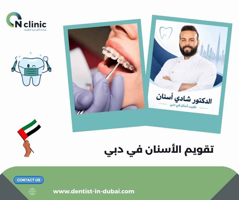 تقويم الأسنان في دبي تقويم الأسنان في دبي