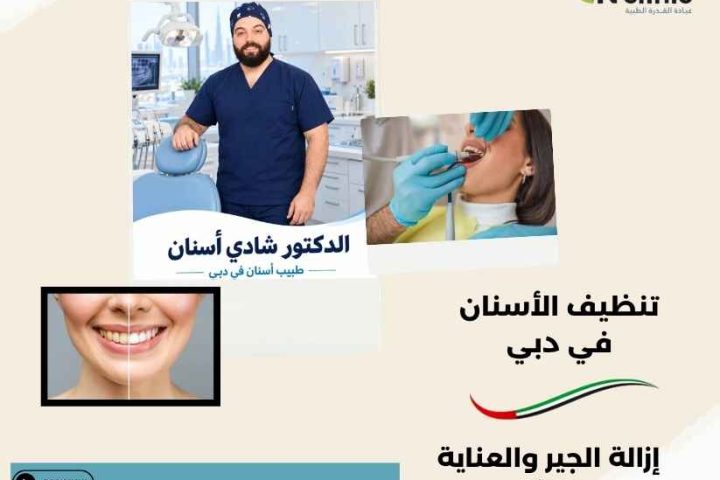 تنظيف الأسنان في دبي