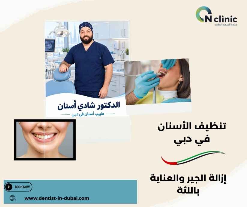 تنظيف الأسنان في دبي