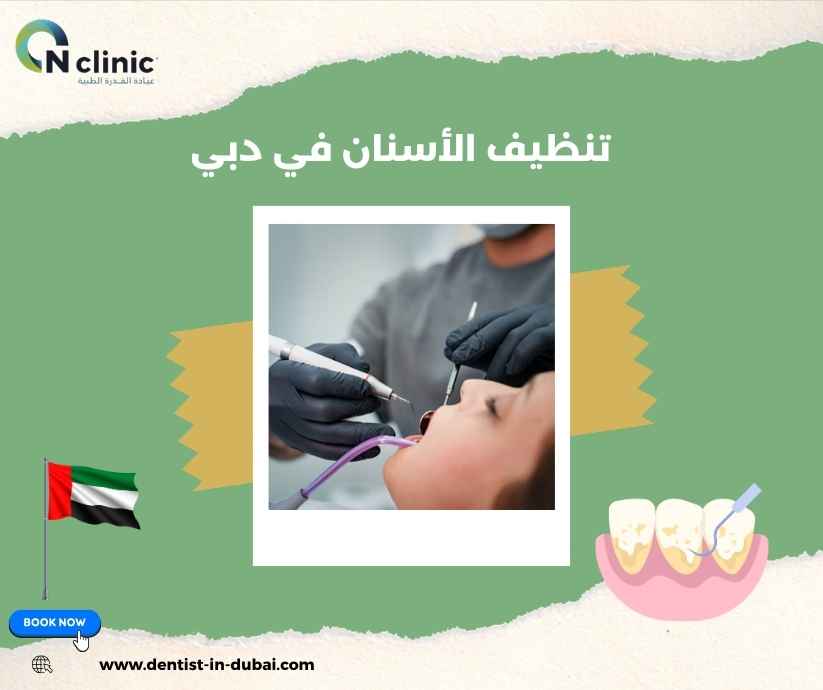 تنظيف الأسنان في دبي