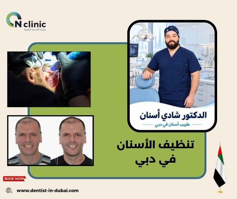 تنظيف الأسنان في دبي