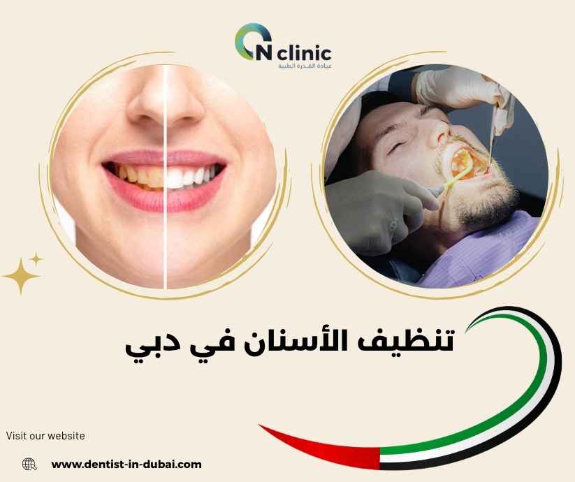 تنظيف الأسنان في دبي