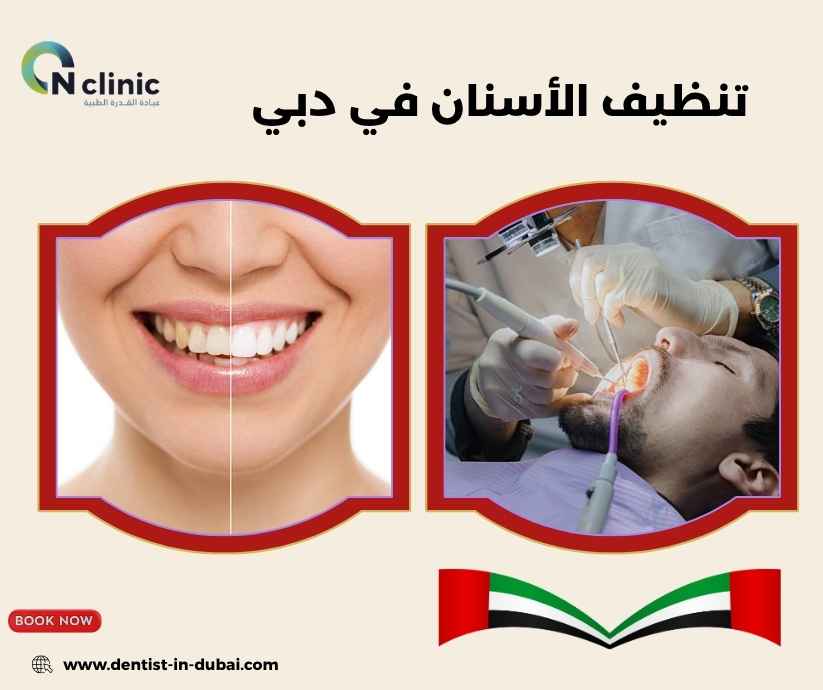 تنظيف الأسنان في دبي