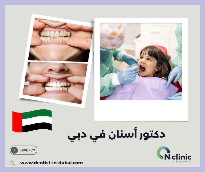 دكتور أسنان في دبي