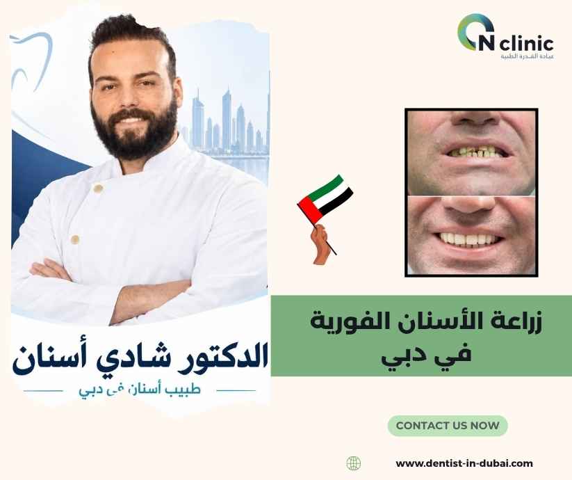 زراعة الأسنان الفورية في دبي