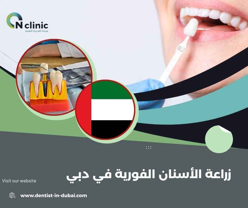 زراعة الأسنان الفورية في دبي