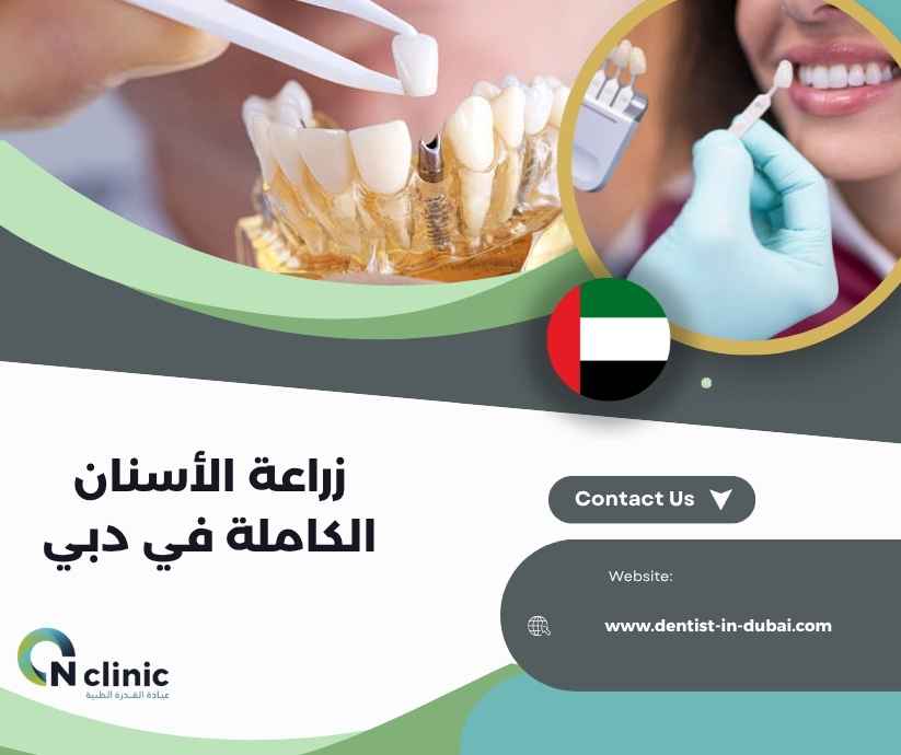 زراعة الأسنان الكاملة في دبي زراعة الأسنان الكاملة في دبي