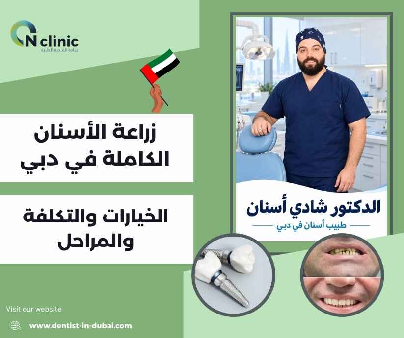 زراعة الأسنان الكاملة في دبي