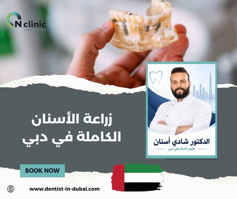 زراعة الأسنان الكاملة في دبي زراعة الأسنان الكاملة في دبي