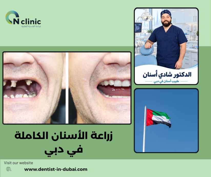 زراعة الأسنان الكاملة في دبي زراعة الأسنان الكاملة في دبي