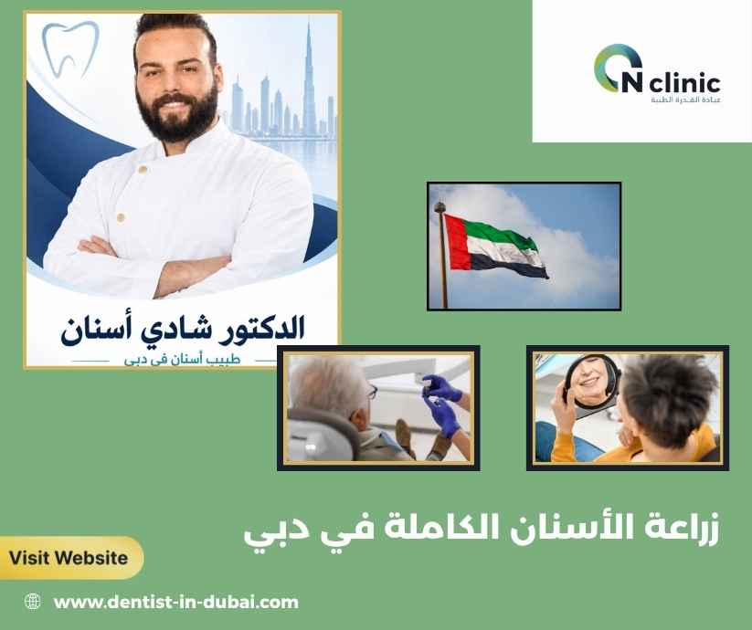 زراعة الأسنان الكاملة في دبي زراعة الأسنان الكاملة في دبي