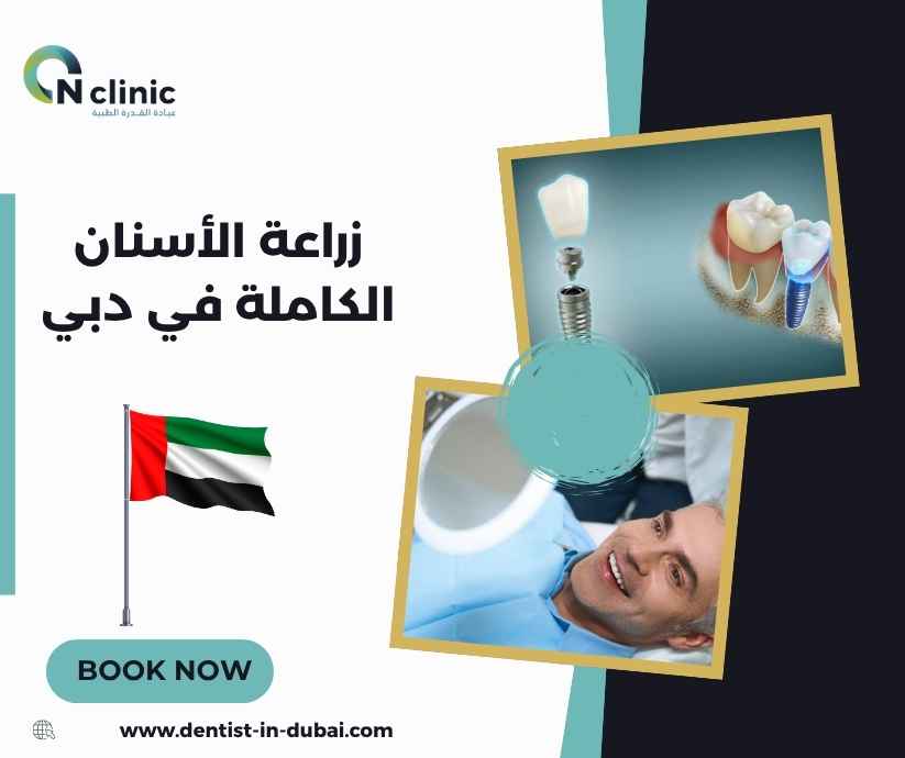 زراعة الأسنان الكاملة في دبي زراعة الأسنان الكاملة في دبي