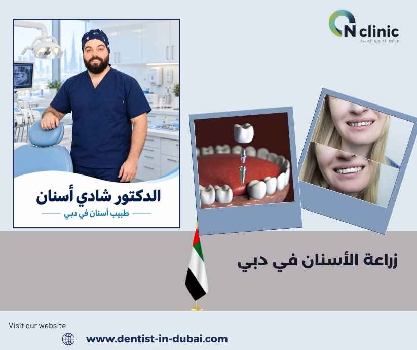 زراعة الأسنان في دبي 