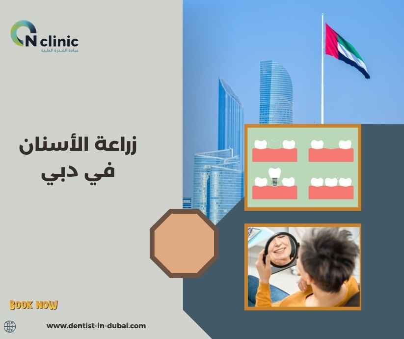 زراعة الأسنان في دبي 