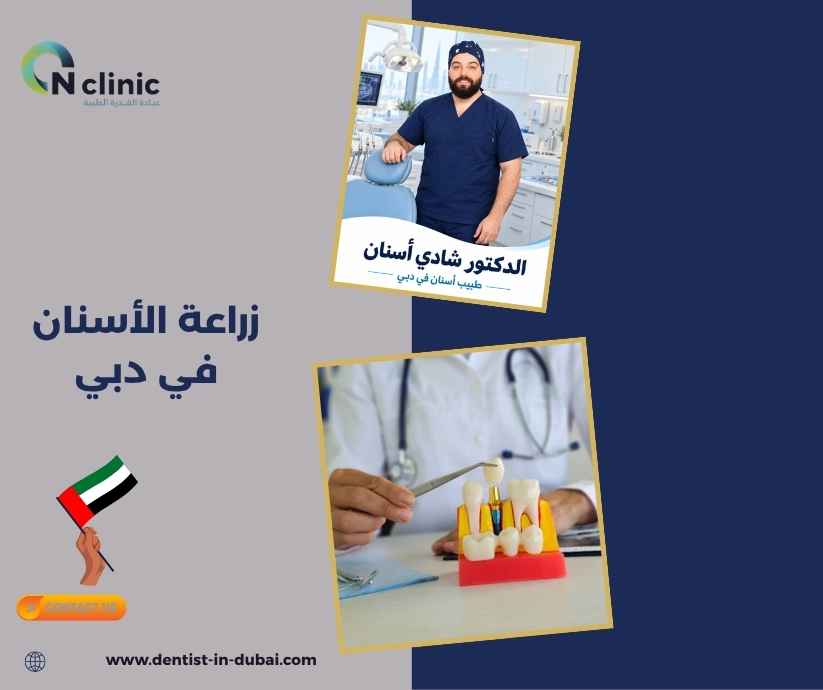 زراعة الأسنان في دبي 