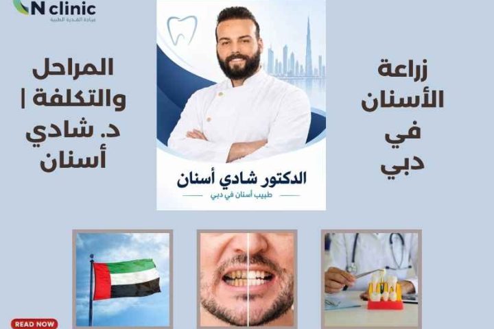 زراعة الأسنان في دبي