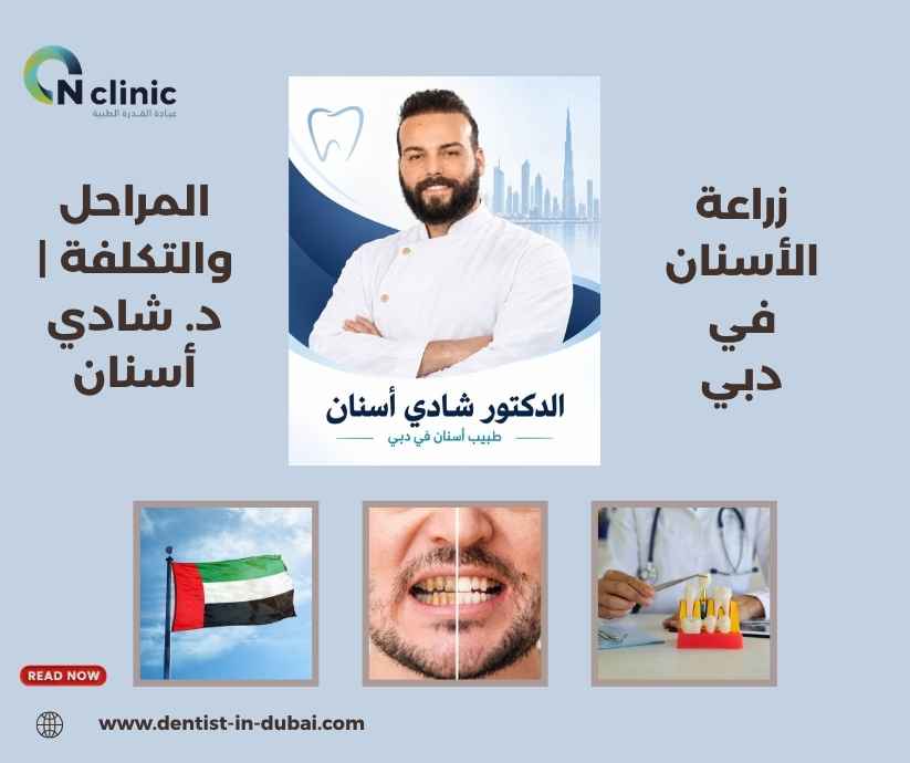 زراعة الأسنان في دبي