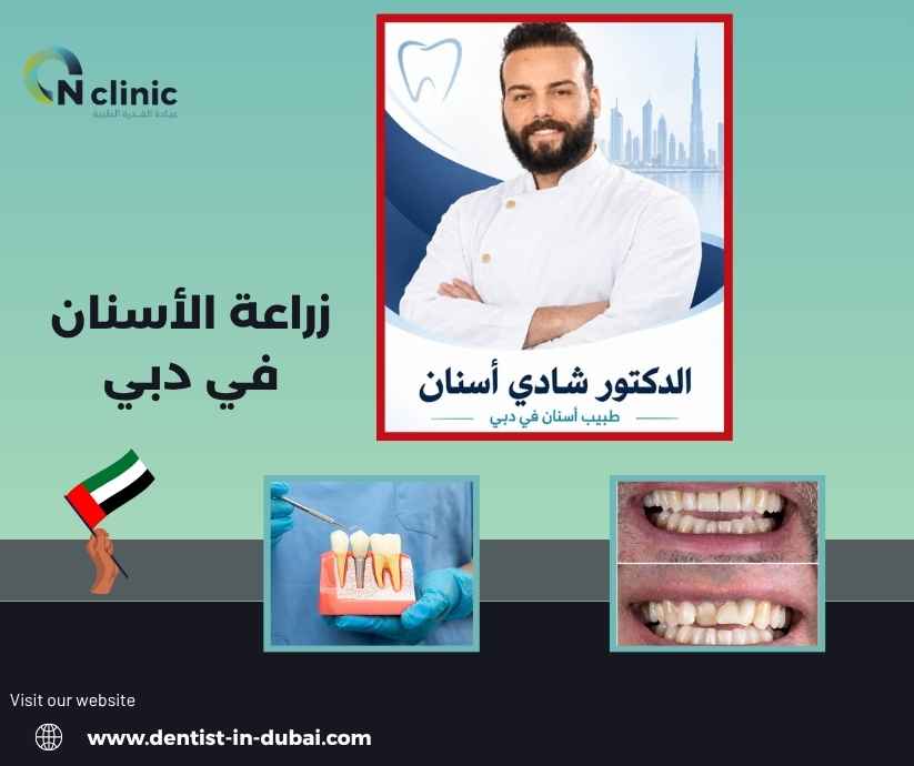 زراعة الأسنان في دبي 