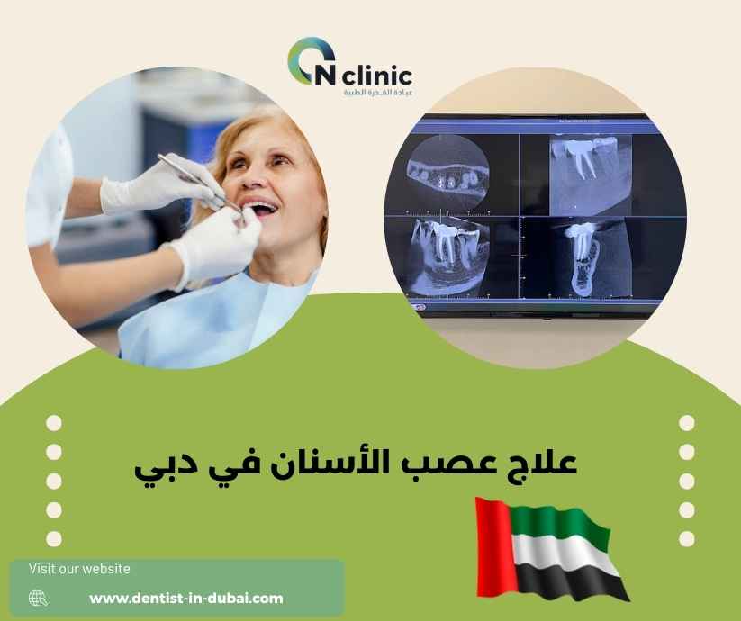 علاج عصب الأسنان في دبي
