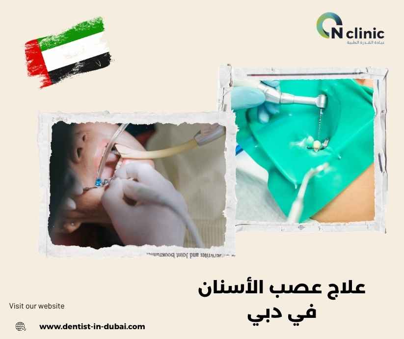 علاج عصب الأسنان في دبي