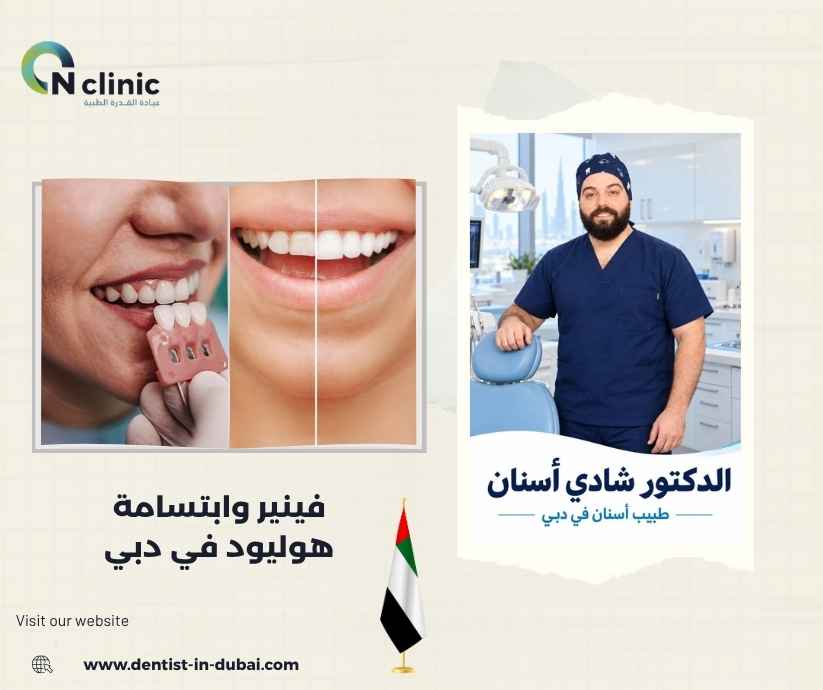 فينير وابتسامة هوليود في دبي
