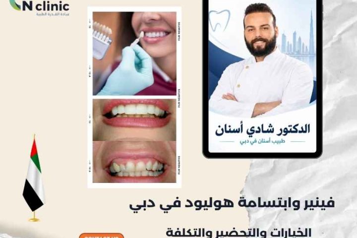 فينير وابتسامة هوليود في دبي