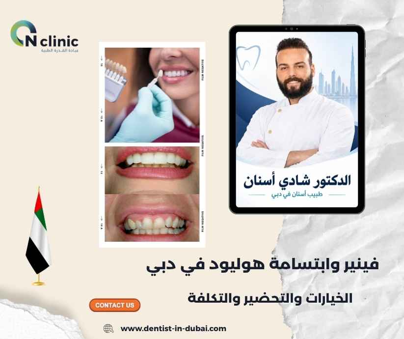 فينير وابتسامة هوليود في دبي